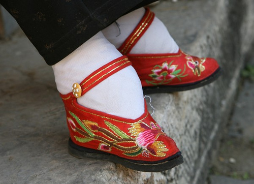 Chinese bound feet